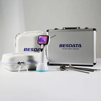 Otoscope BESDATA באיכות גבוהה מפעל מחיר HD מקור אור אנדוסקופ וידאו דיגיטלי Otoscope על אף אוזן גרון בדיקה, אבחנות